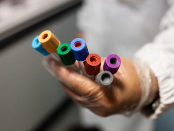 Svelare l’Alzheimer 15 anni prima dei sintomi, la speranza in un esame del sangue